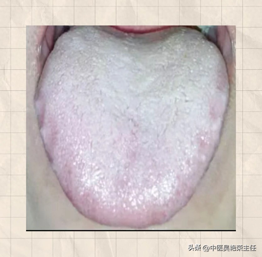 One Minute to Teach You How to Identify Body Constitution by